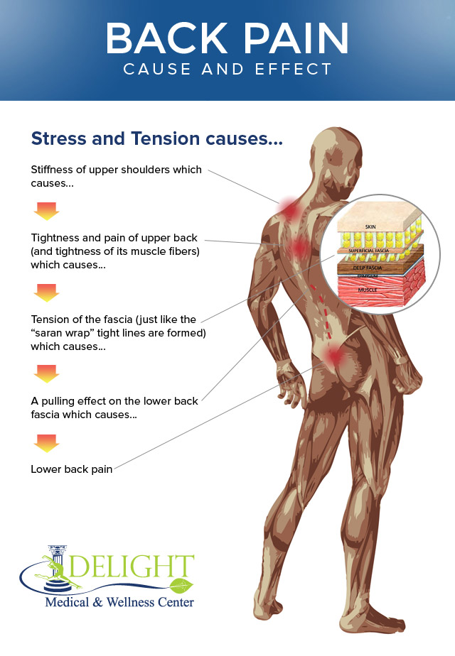 Myofascial Release For Back Pain Los Angeles Santa Monica CA