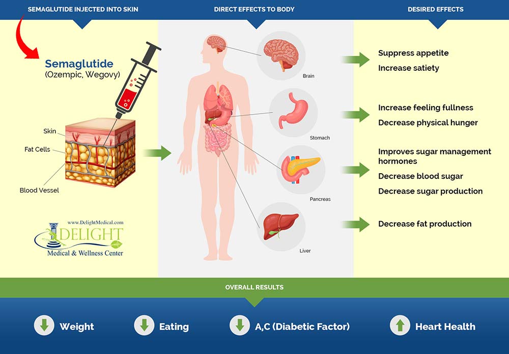 Elementary Facts About Semaglutide Wegovy Or Ozempic As Effective In 